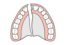 Repairs Relines Icon