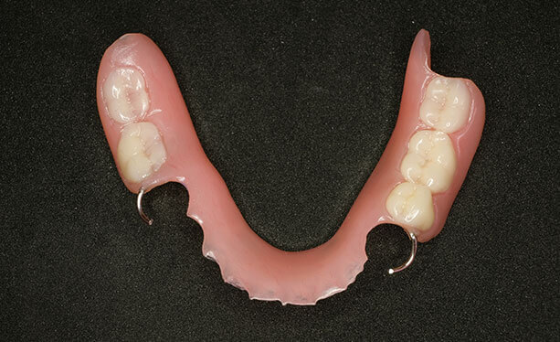 Acrylic Removable Partial Denture (flipper)