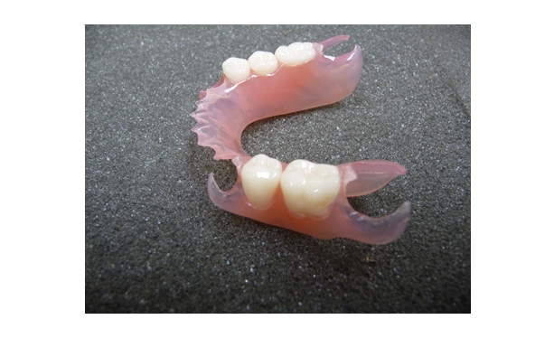 Valplast An Innovative Flexible Partial Denture No Wires